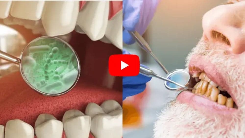 Try This 60-Second Ritual to Rebuild Your Teeth and Gums
